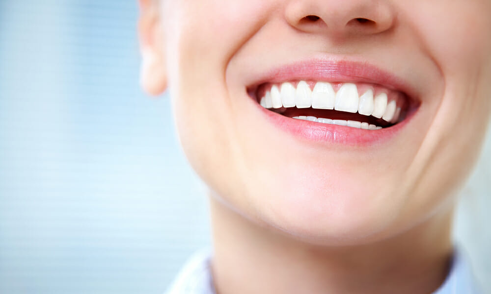 Tooth Whitening